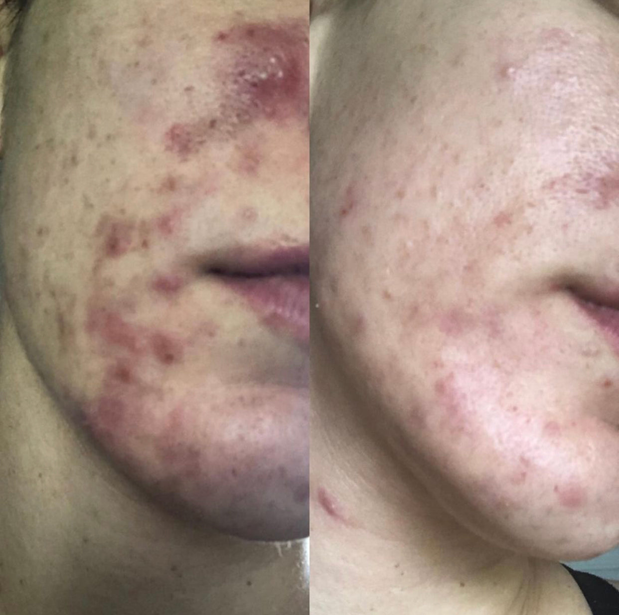 Transformations – Skin Love Clinic